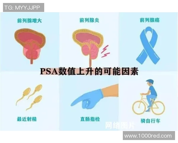 患前列腺癌，前纽卡门将：一年前已承受手术，但癌仍是在分散